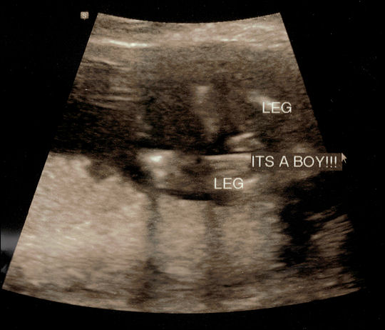 It's a boy