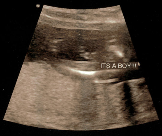 It's a boy