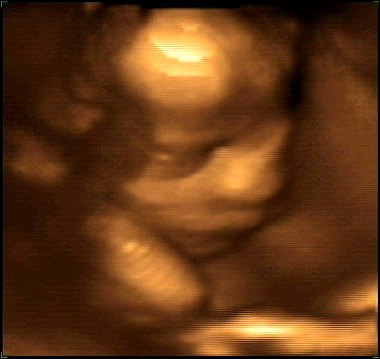 Evan's 4-D ultrasound at 30 weeks