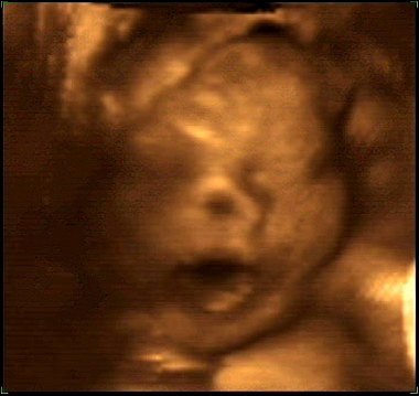 Evan's 4-D ultrasound at 30 weeks
