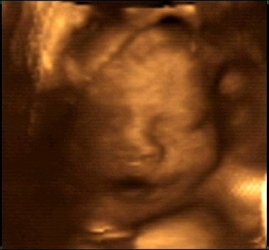 Evan's 4-D ultrasound at 30 weeks