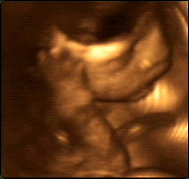 Evan's 4-D ultrasound at 30 weeks