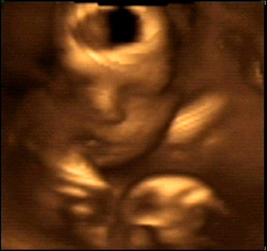 Evan's 4-D ultrasound at 30 weeks