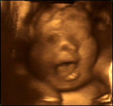 Evan's 4-D ultrasound at 30 weeks